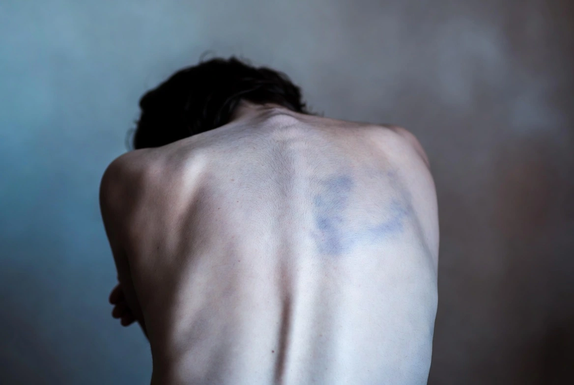 Dorsal Vagal Shutdown and ADHD